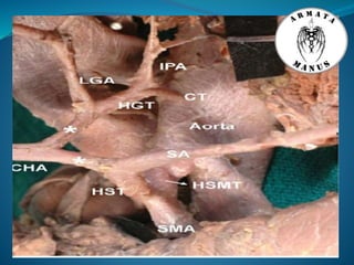 Celiac trunk anatomy