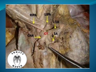 Celiac trunk anatomy