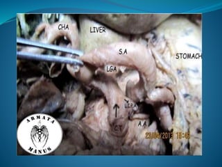 Celiac trunk anatomy