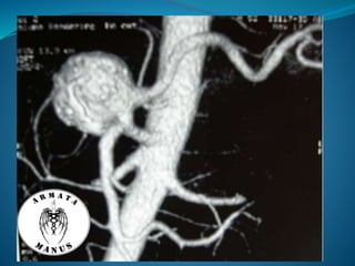Celiac trunk anatomy