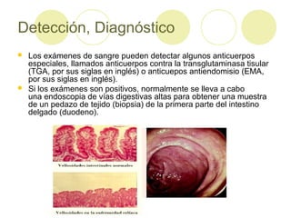 Detección, Diagnóstico




Los exámenes de sangre pueden detectar algunos anticuerpos
especiales, llamados anticuerpos contra la transglutaminasa tisular
(TGA, por sus siglas en inglés) o anticuepos antiendomisio (EMA,
por sus siglas en inglés).
Si los exámenes son positivos, normalmente se lleva a cabo
una endoscopia de vías digestivas altas para obtener una muestra
de un pedazo de tejido (biopsia) de la primera parte del intestino
delgado (duodeno).

 