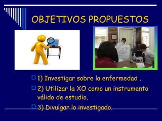 OBJETIVOS PROPUESTOS
 1) Investigar sobre la enfermedad .
 2) Utilizar la XO como un instrumento
válido de estudio.
 3) Divulgar lo investigado.
 