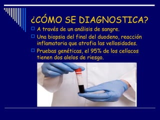 ¿CÓMO SE DIAGNOSTICA?
 A través de un análisis de sangre.
 Una biopsia del final del duodeno, reacción
inflamatoria que atrofia las vellosidades.
 Pruebas genéticas, el 95% de los celíacos
tienen dos alelos de riesgo.
 