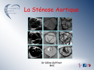 La Sténose Aortique




      Dr Céline Goffinet
              BHC
 