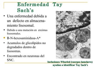 Enfermedad Tay
            Sach’s
• Una enfermedad debida a
    un defecto en almacena-
    miento lisosomal.
•   Debido a una mutación en enzimas
    lisosomales.
 Β-N-hexosaminidasa-A*
• Acumulos de glicolípidos no
  degradados dentro de
  lisosomas.
• Encontrado en neuronas del
  SNC.                             Inclusiones Whorled (cuerpos lamelares)
                                        ayudan a identificar Tay Sach’s
 