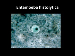 Entamoeba histolytica
 