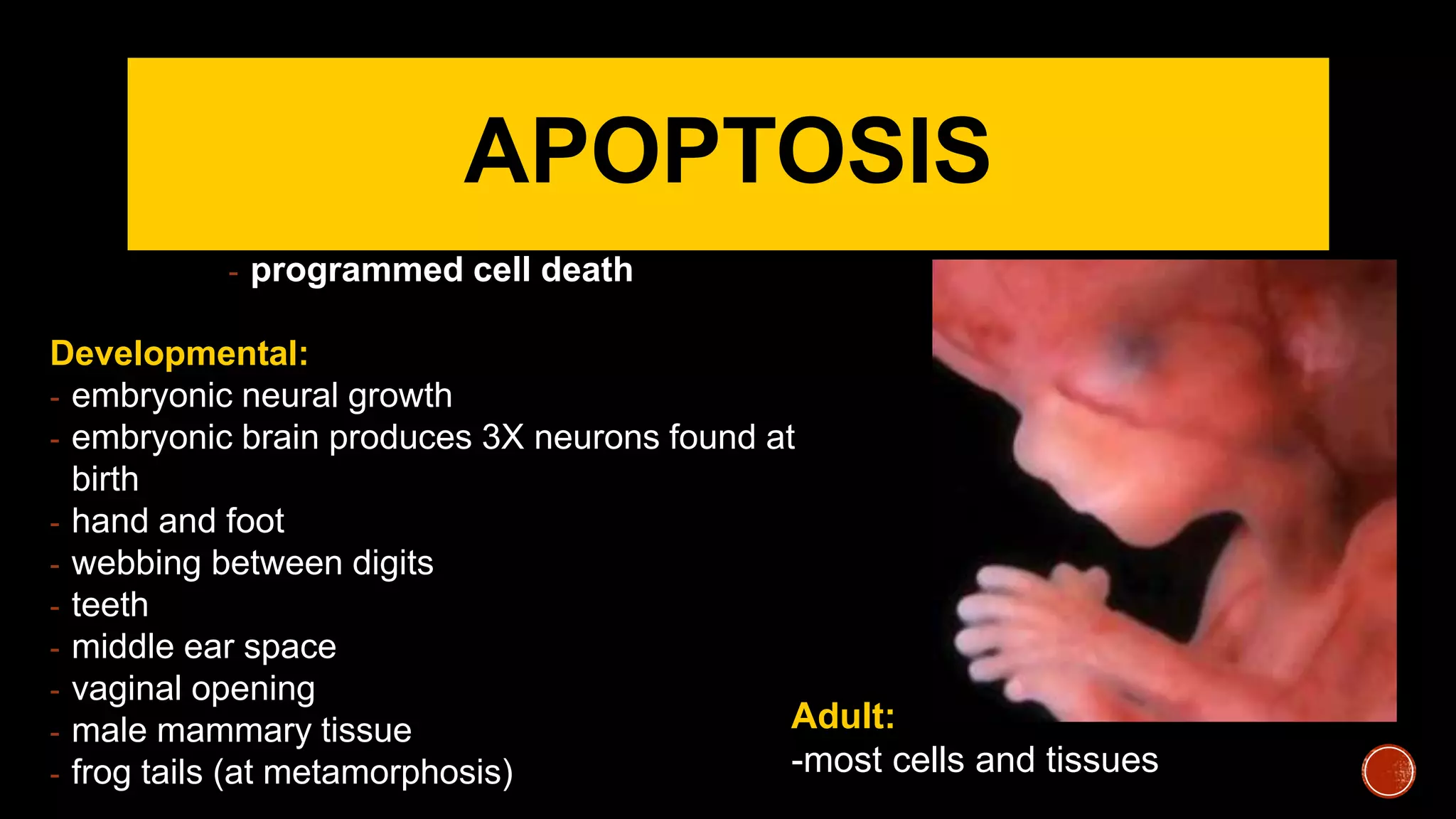 APOPTOSIS
- programmed cell death
Developmental:
- embryonic neural growth
- embryonic brain produces 3X neurons found at
birth
- hand and foot
- webbing between digits
- teeth
- middle ear space
- vaginal opening
- male mammary tissue
- frog tails (at metamorphosis)
Adult:
-most cells and tissues
 