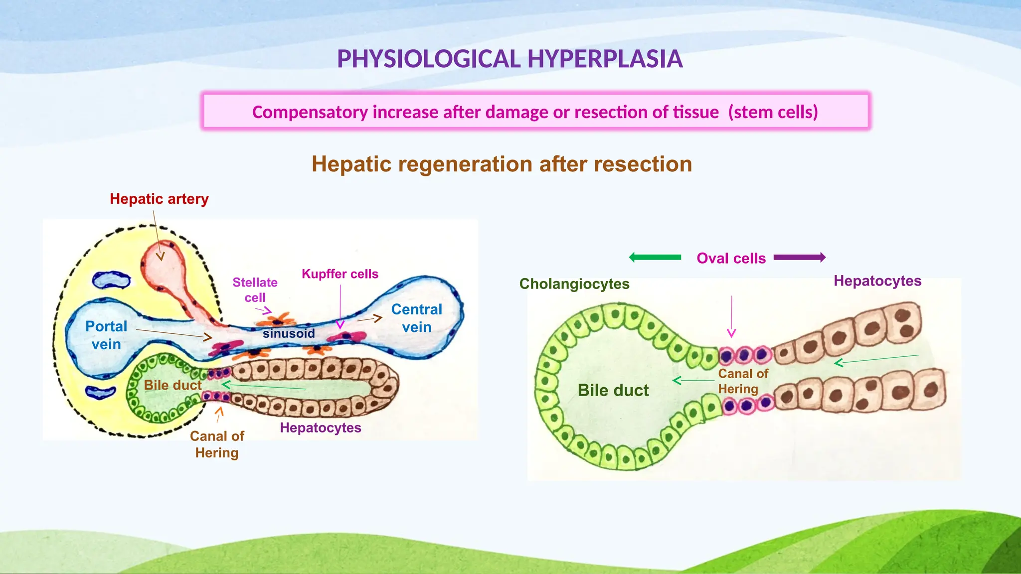 PHYSIOLOGICAL HYPERPLASIA
Compensatory increase after damage or resection of tissue (stem cells)
Portal
vein
Central
vein
Hepatic artery
Bile duct
Canal of
Hering
Stellate
cell
Kupffer cells
Hepatocytes
Oval cells
sinusoid
Cholangiocytes Hepatocytes
Bile duct
Canal of
Hering
Hepatic regeneration after resection
 