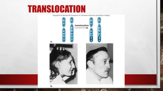 24-
180
TRANSLOCATION
 