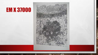 EM X 37OOO
 