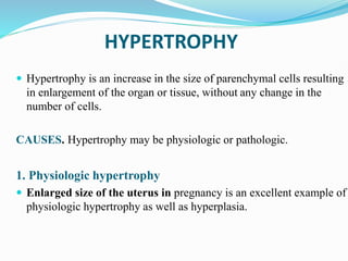 HYPERTROPHY
 Hypertrophy is an increase in the size of parenchymal cells resulting
in enlargement of the organ or tissue, without any change in the
number of cells.
CAUSES. Hypertrophy may be physiologic or pathologic.
1. Physiologic hypertrophy
 Enlarged size of the uterus in pregnancy is an excellent example of
physiologic hypertrophy as well as hyperplasia.
 