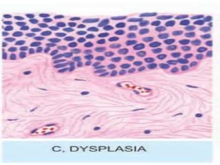cell adaptation or cellular adaptation-190708165026.pptx