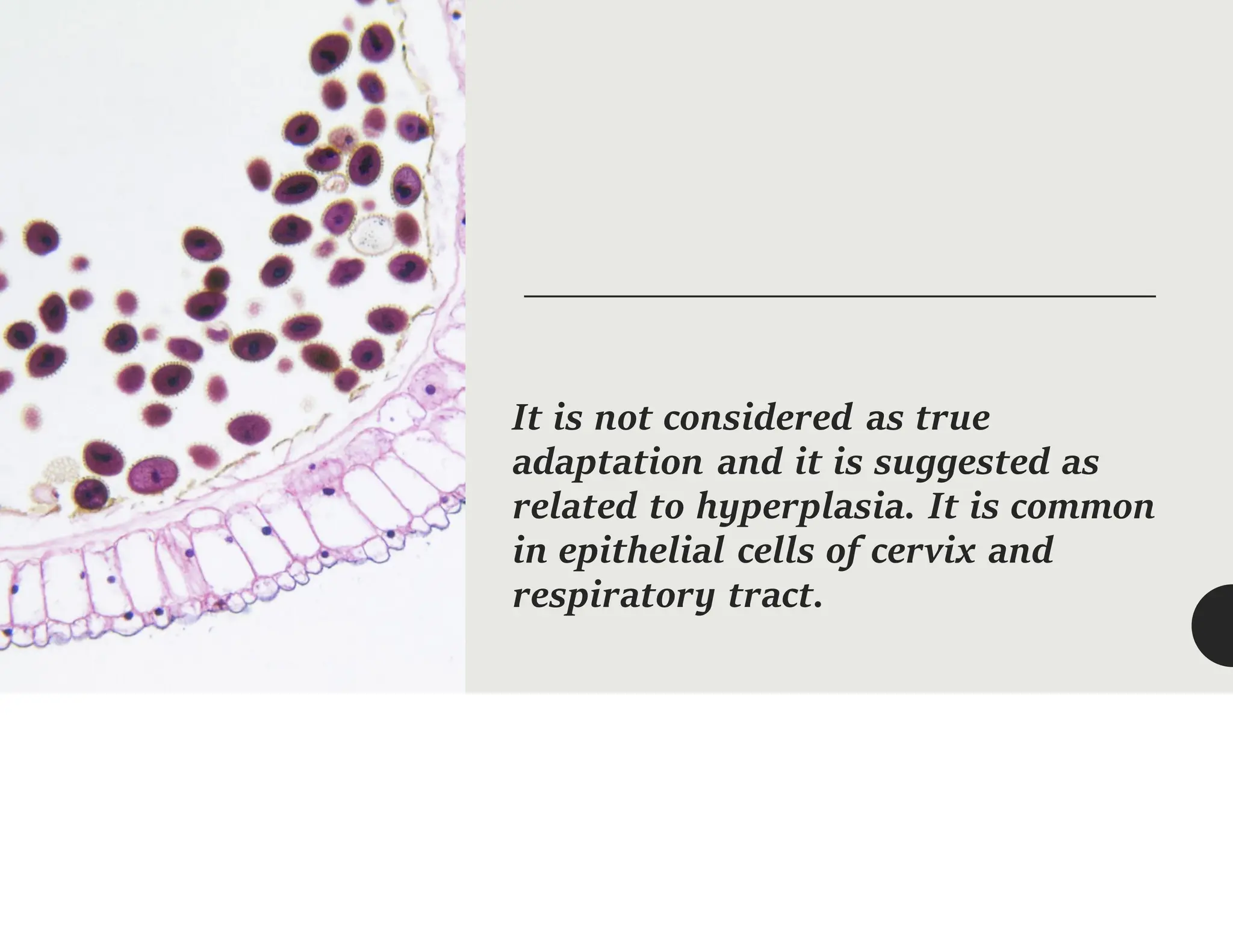 Cell Adaptation, physiology and pathology....pdf