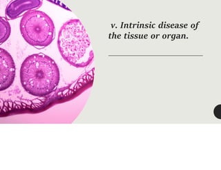 v. Intrinsic disease of
the tissue or organ.
 