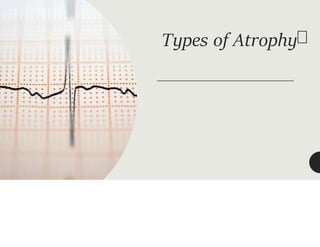 Types of Atrophy
 