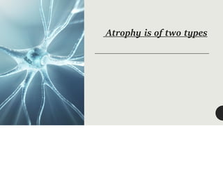 Atrophy is of two types
 
