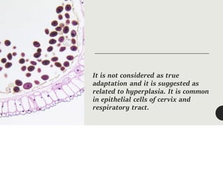 It is not considered as true
adaptation and it is suggested as
related to hyperplasia. It is common
in epithelial cells of cervix and
respiratory tract.
 