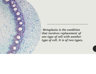 Metaplasia is the condition
that involves replacement of
one type of cell with another
type of cell. It is of two types.
 