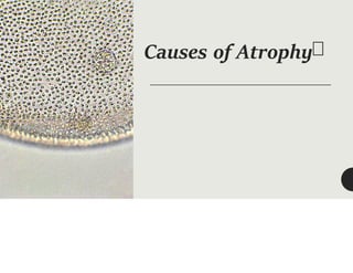 Causes of Atrophy
 