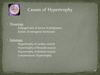 Causes   of   Hypertrophy Physiologic Enlarged size of uterus in pregnancy Action of estrogenic hormones Pathologic Hypertrophy of cardiac muscle Hypertrophy of Smooth muscle Hypertrophy of skeletal muscle Compensatory Hypertrophy 