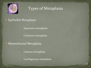 Types of Metaplasia Epithelial Metaplasia Squamous metaplasia Columnar metaplasia Mesenchymal Metaplasia Osseous metaplasia Cartilagenous metaplasia 