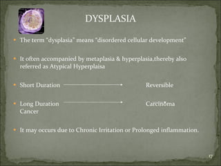 DYSPLASIA The term “dysplasia” means “disordered cellular development” It often accompanied by metaplasia & hyperplasia,thereby also referred as Atypical Hyperplaisa Short Duration Reversible Long Duration Carcinoma Cancer It may occurs due to Chronic Irritation or Prolonged inflammation. 
