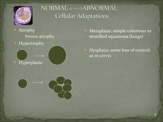 Atrophy brown atrophy Hypertrophy Hyperplasia Metaplasia: simple columnar to stratified squamous (lungs) Dysplasia: some loss of control as in cervix 