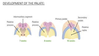 DEVELOPMENT OF THE PALATE:
 