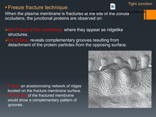 Freeze fracture technique:
When the plasma membrane is fractured at the site of the zonula
occludens, the junctional proteins are observed on:
the P-face of the membrane, where they appear as ridgelike
structures.
the E-face, reveals complementary grooves resulting from
detachment of the protein particles from the opposing surface.
• P face: an anastomosing network of ridges
located on the fracture membrane surface.
• The E-face of the fractured membrane
would show a complementary pattern of
grooves.
Tight Junction
 