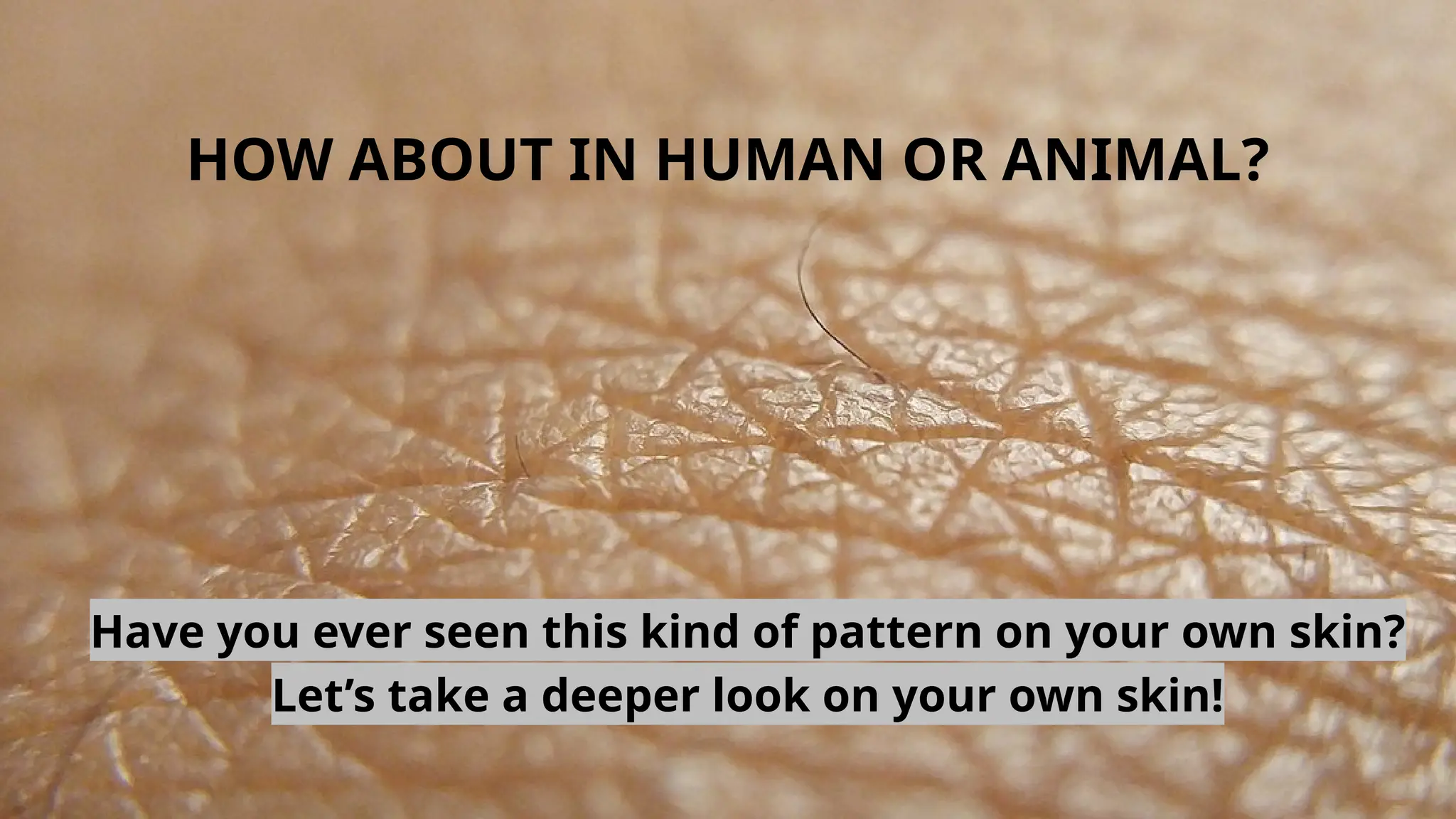 HOW ABOUT IN HUMAN OR ANIMAL?
Have you ever seen this kind of pattern on your own skin?
Let’s take a deeper look on your own skin!
 