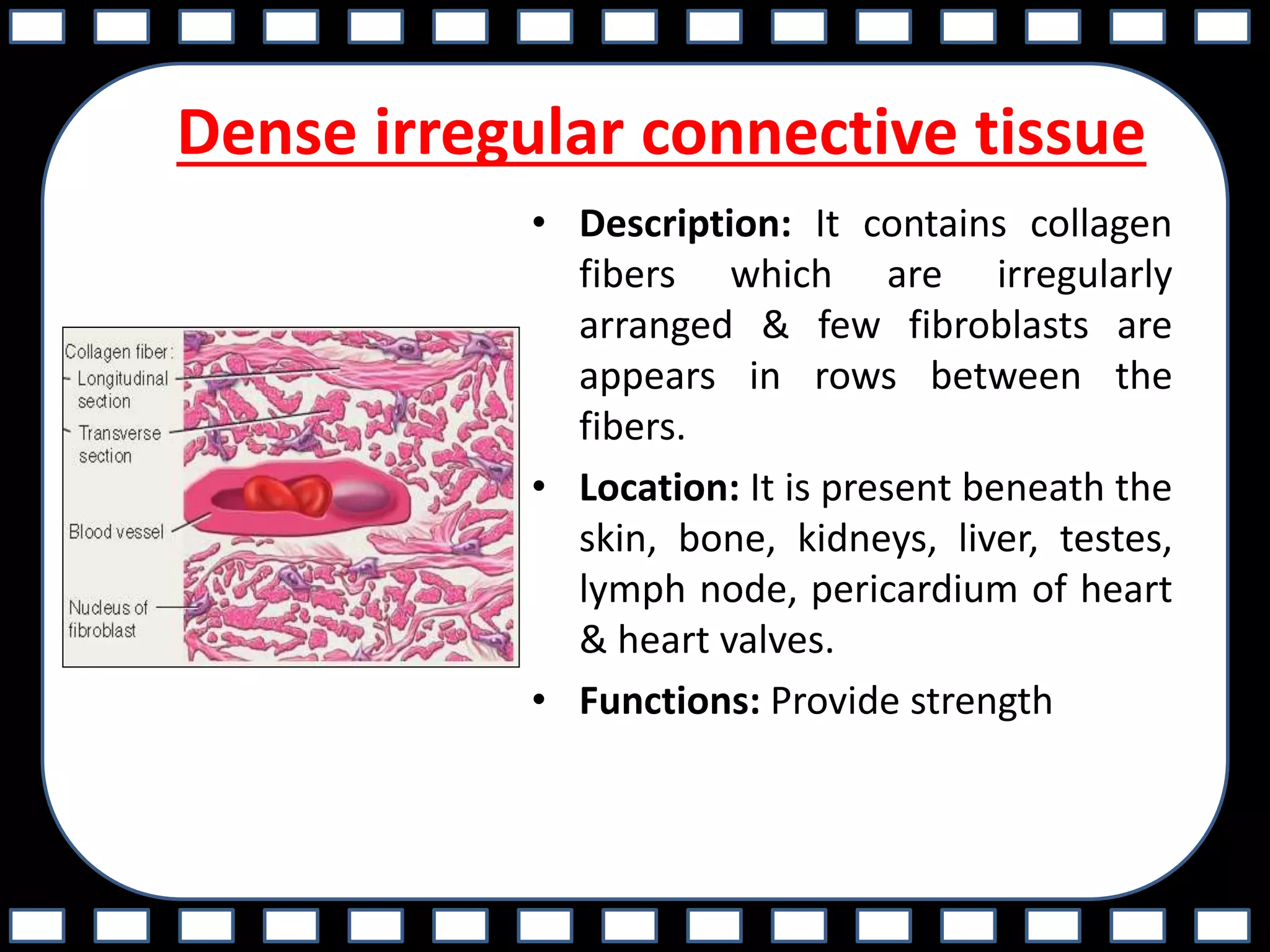 Dense irregular connective tissue
• Description: It contains collagen
fibers which are irregularly
arranged & few fibroblasts are
appears in rows between the
fibers.
• Location: It is present beneath the
skin, bone, kidneys, liver, testes,
lymph node, pericardium of heart
& heart valves.
• Functions: Provide strength
 