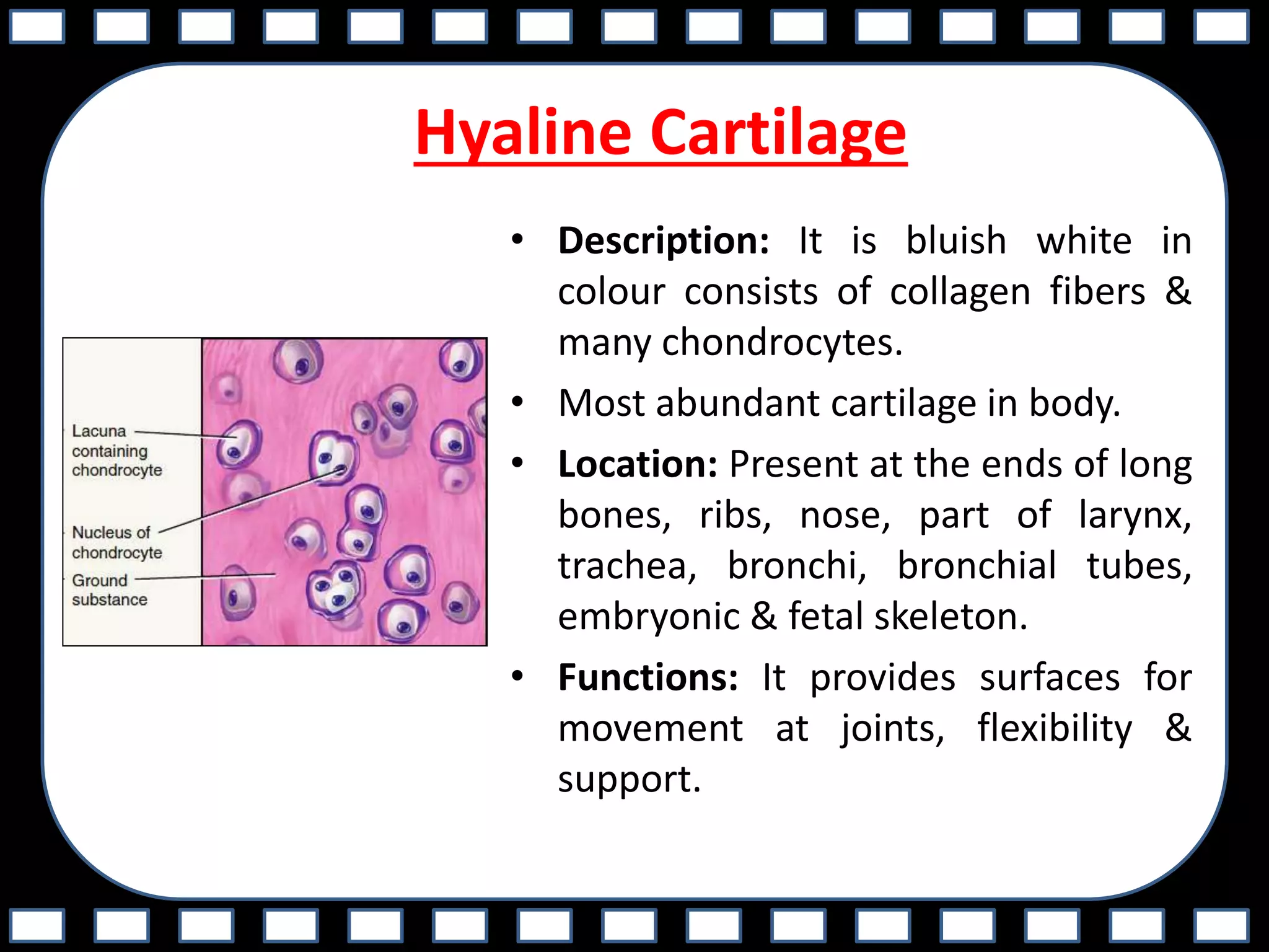 Hyaline Cartilage
• Description: It is bluish white in
colour consists of collagen fibers &
many chondrocytes.
• Most abundant cartilage in body.
• Location: Present at the ends of long
bones, ribs, nose, part of larynx,
trachea, bronchi, bronchial tubes,
embryonic & fetal skeleton.
• Functions: It provides surfaces for
movement at joints, flexibility &
support.
 