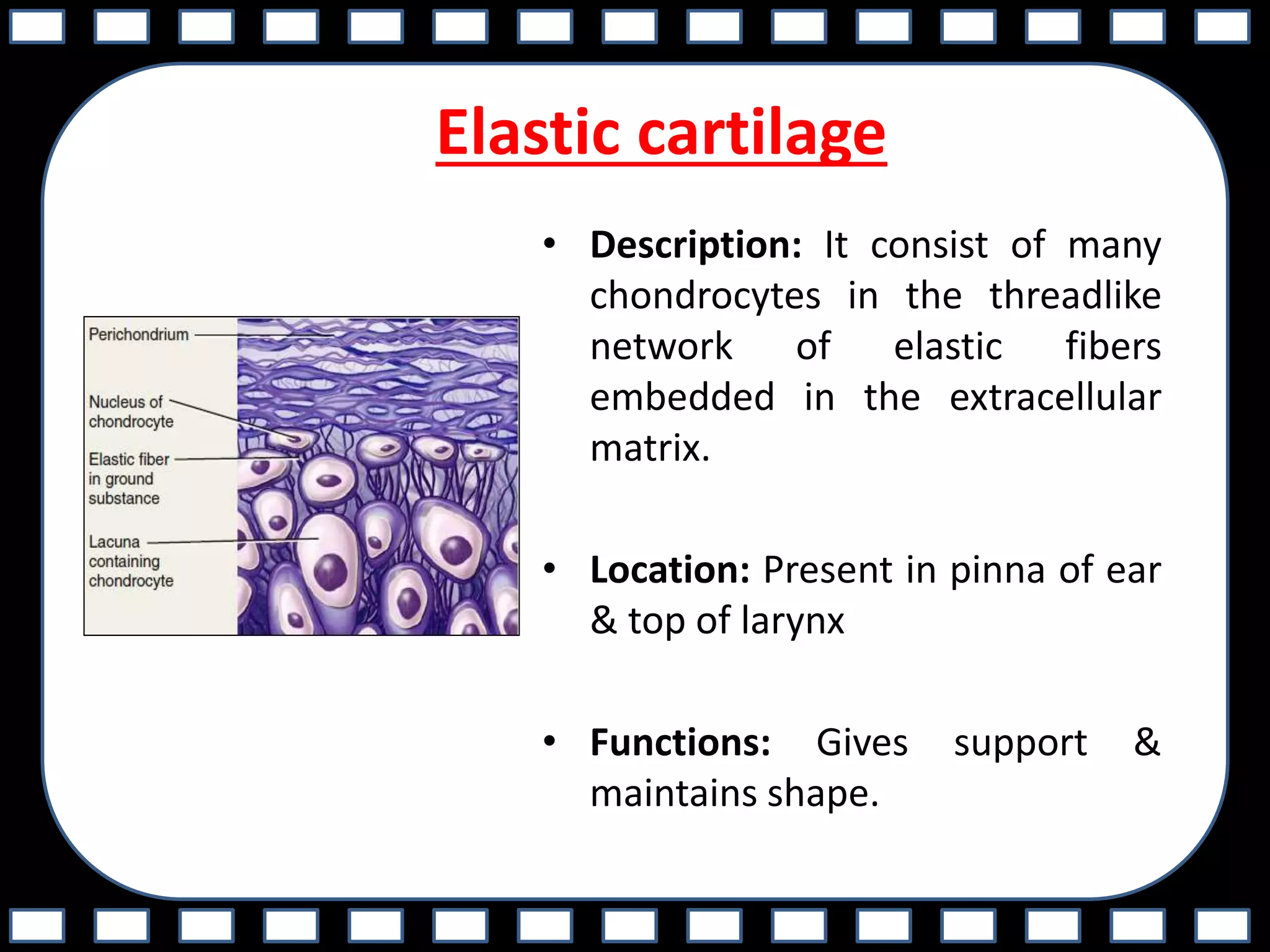 Elastic cartilage
• Description: It consist of many
chondrocytes in the threadlike
network of elastic fibers
embedded in the extracellular
matrix.
• Location: Present in pinna of ear
& top of larynx
• Functions: Gives support &
maintains shape.
 