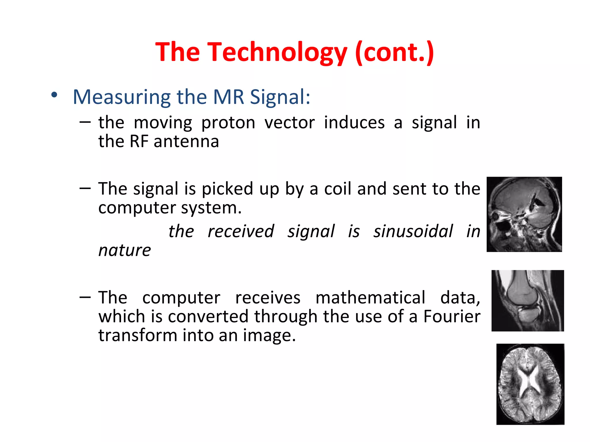 The Technology (cont.) Measuring the MR Signal: the moving proton vector induces a signal in the RF antenna The signal is picked up by a coil and sent to the computer system. the received signal is sinusoidal in nature   The computer receives mathematical data, which is converted through the use of a Fourier transform into an image. 