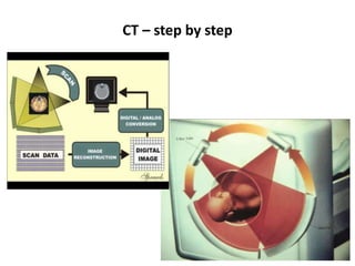 CT – step by step
 