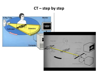 CT – step by step
 