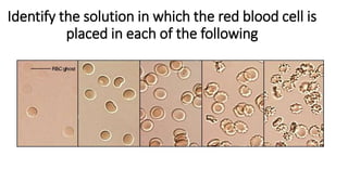 Identify the solution in which the red blood cell is
placed in each of the following
 