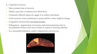 1. Coagulative necrosis :
✓ Most common type of necrosis.
✓ Mainly cause due to ischemia (low blood flow)
✓ Commonly affected organs are, heart, liver, kidney and spleen.
✓ In this necrosis, tissue architecture is preserved but, colour might be change.
✓ Coagulative necrosis does not found in brain.
✓ Pathogenesis : degeneration of enzymes and structural proteins due to,
accumulation of lactic acid, heavy metals or expose to ionizing radiation.
✓ E.g. myocardial infraction, zenker’s degenerative necrosis etc.
 