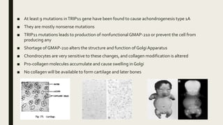 ■ At least 9 mutations inTRIP11 gene have been found to cause achondrogenesis type 1A
■ They are mostly nonsense mutations
■ TRIP11 mutations leads to production of nonfunctionalGMAP-210 or prevent the cell from
producing any
■ Shortage of GMAP-210 alters the structure and function of GolgiApparatus
■ Chondrocytes are very sensitive to these changes, and collagen modification is altered
■ Pro-collagen molecules accumulate and cause swelling in Golgi
■ No collagen will be available to form cartilage and later bones
 