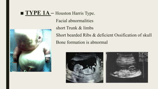 ■ TYPE 1A – Houston Harris Type.
Facial abnormalities
short Trunk & limbs
Short bearded Ribs & deficient Ossification of skull
Bone formation is abnormal
 