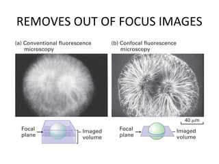 REMOVES OUT OF FOCUS IMAGES
 