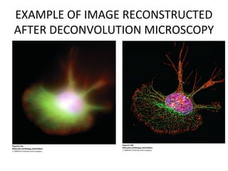 EXAMPLE OF IMAGE RECONSTRUCTED
AFTER DECONVOLUTION MICROSCOPY
 