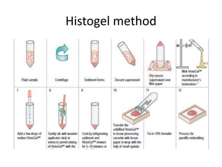 Histogel method
 