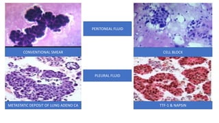 Cell Block Compression Cell block.pdf