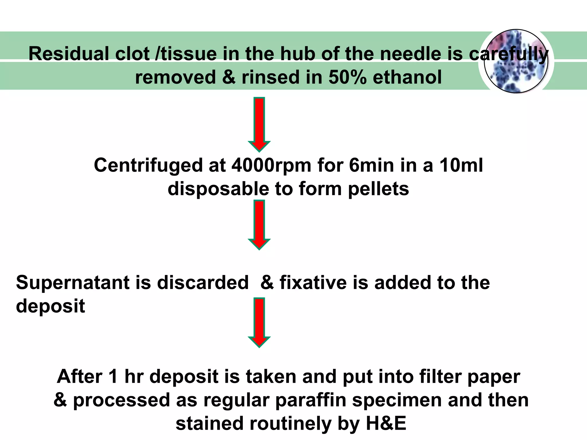 Residual clot /tissue in the hub of the needle is carefully
removed & rinsed in 50% ethanol
Centrifuged at 4000rpm for 6min in a 10ml
disposable to form pellets
Supernatant is discarded & fixative is added to the
deposit
After 1 hr deposit is taken and put into filter paper
& processed as regular paraffin specimen and then
stained routinely by H&E
 