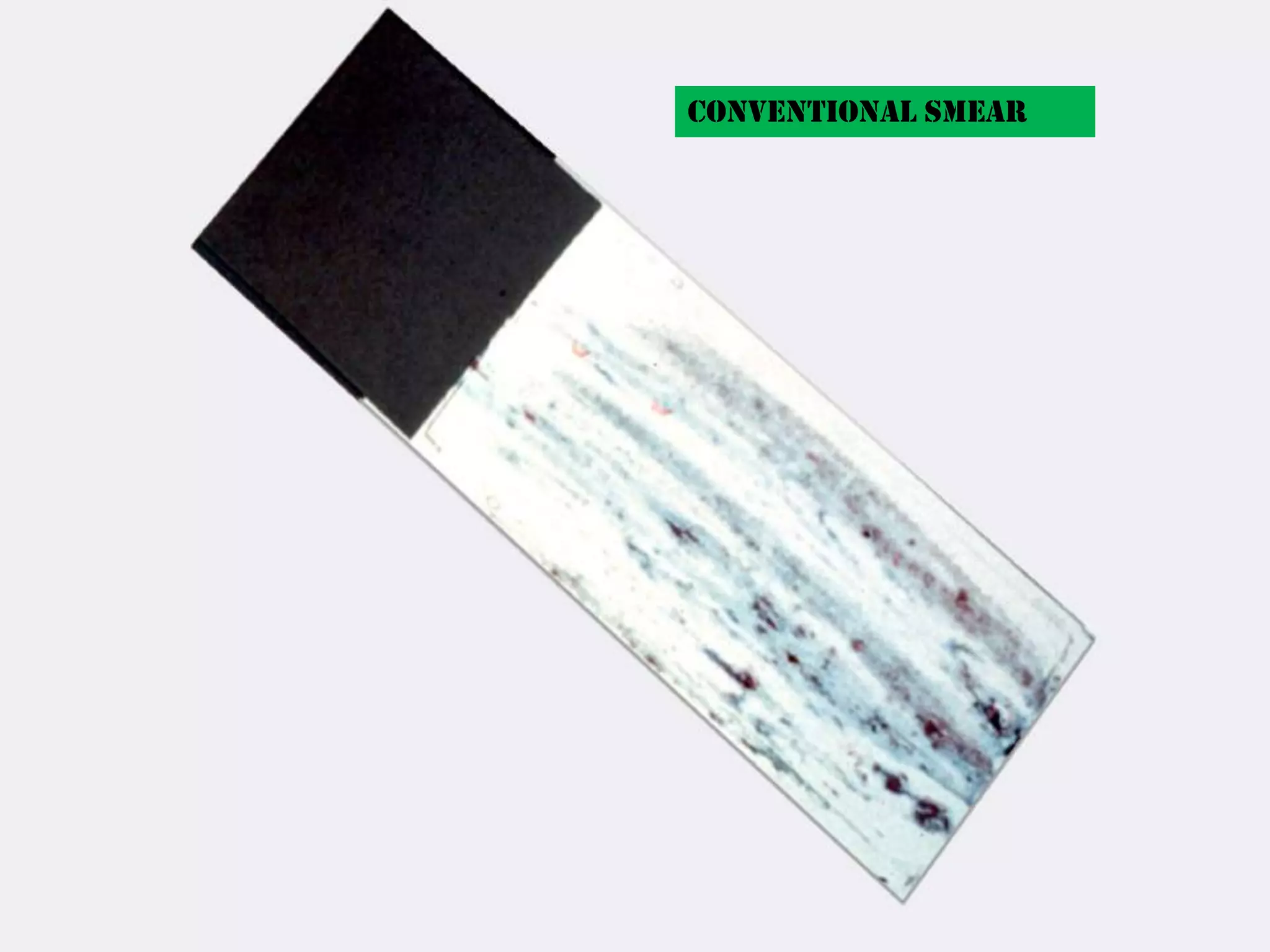 Conventional smear
 