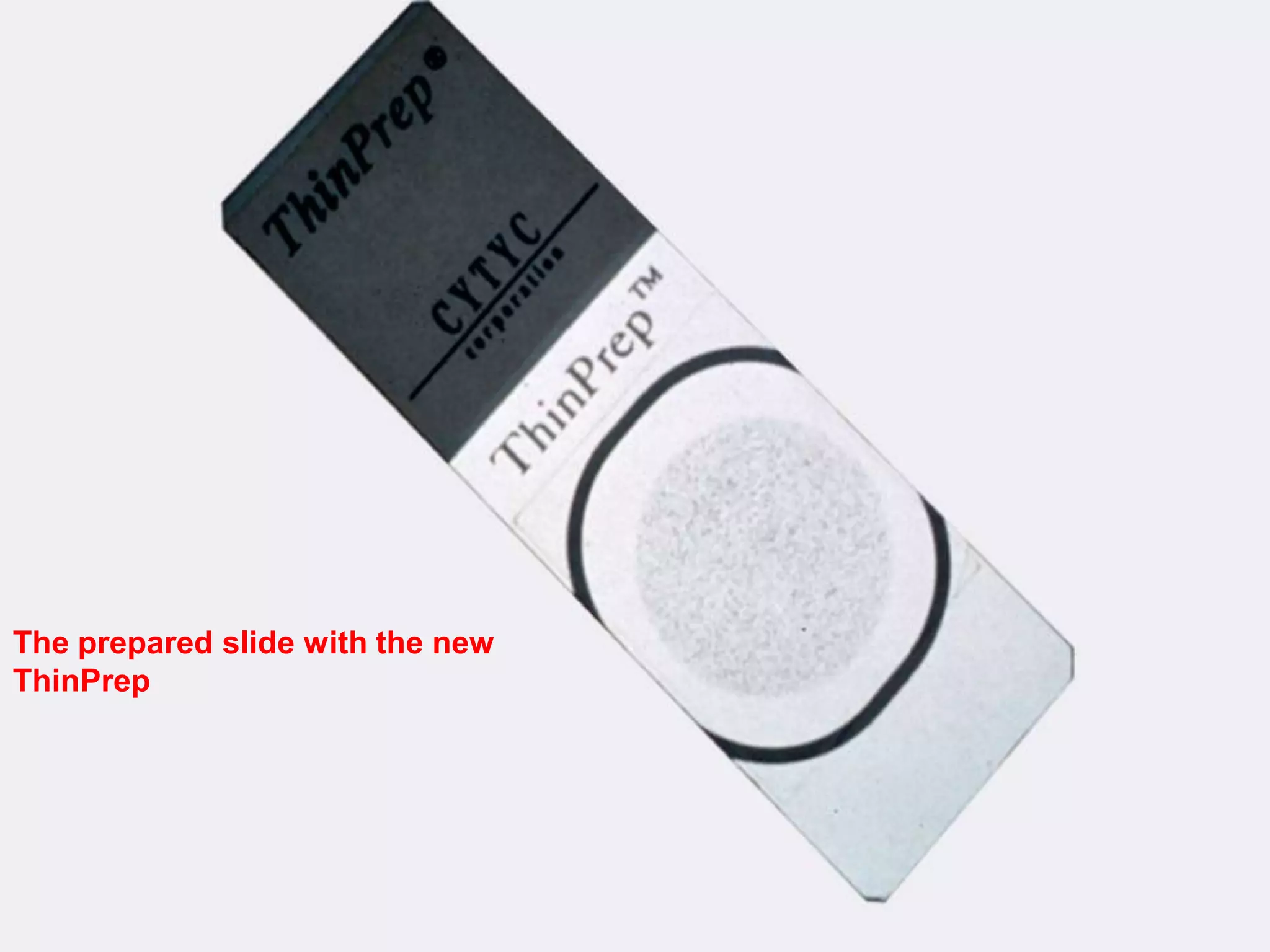 The prepared slide with the new
ThinPrep
 