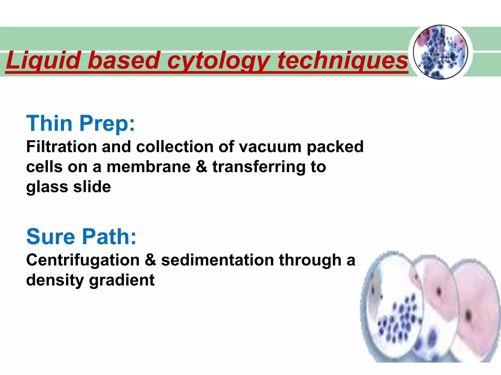 Liquid based cytology techniques
Thin Prep:
Filtration and collection of vacuum packed
cells on a membrane & transferring to
glass slide
Sure Path:
Centrifugation & sedimentation through a
density gradient
 