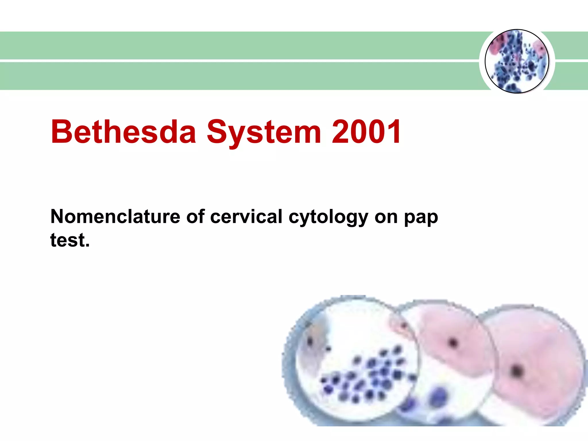 Bethesda System 2001
Nomenclature of cervical cytology on pap
test.
 