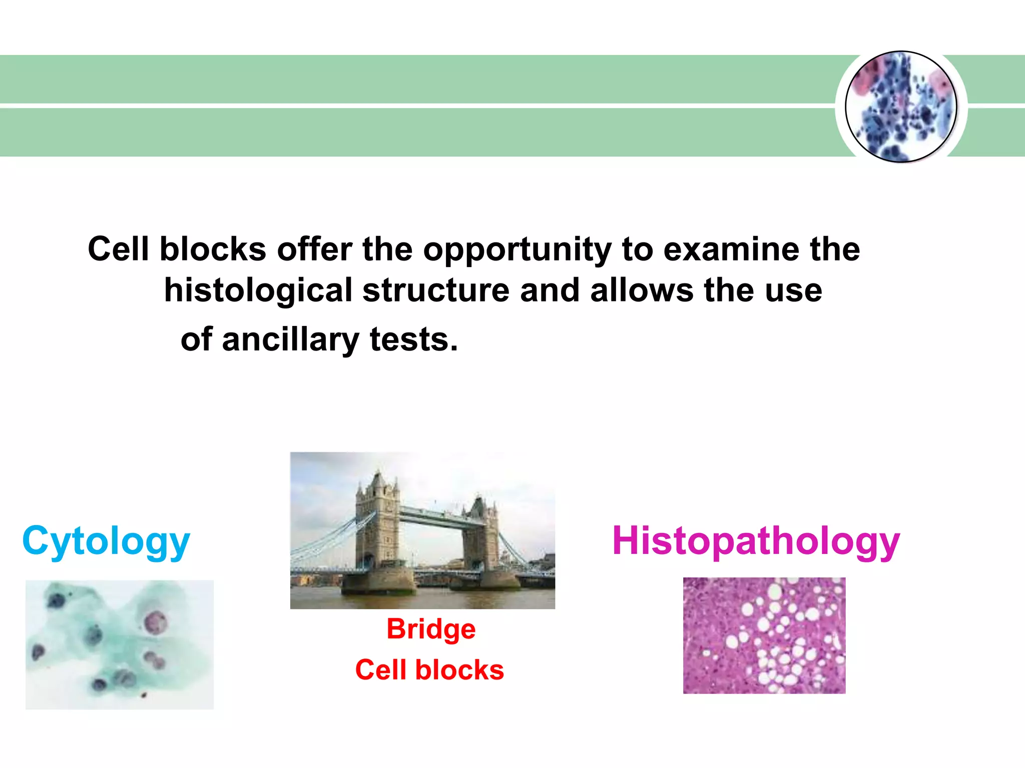 Cell blocks offer the opportunity to examine the
histological structure and allows the use
of ancillary tests.
Cytology Histopathology
Bridge
Cell blocks
 
